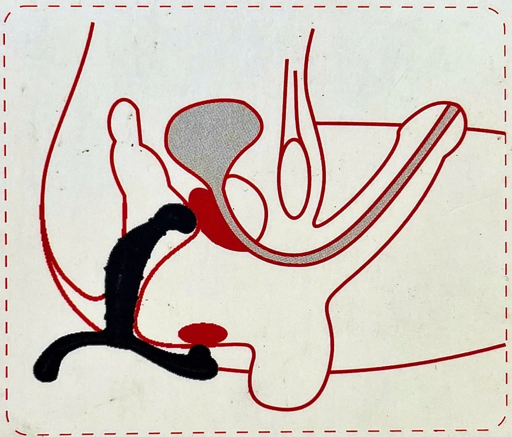 Thanh massage điểm G nam giới silicone đúc đặc