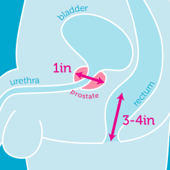 Ưu điểm dụng cụ massage prostate không dùng điện